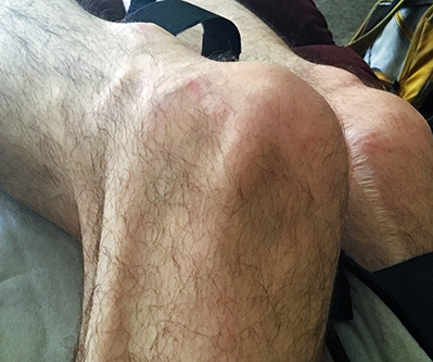 watt's fucked-up port-side knee on sep 22, 2022 watt's fucked-up port-side knee on sep 22, 2022